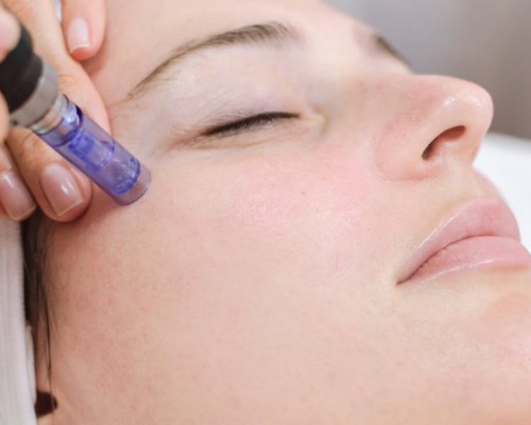 Dermapen + limpieza express