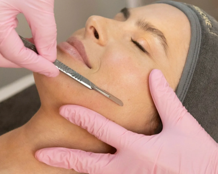 Dermaplanning facial