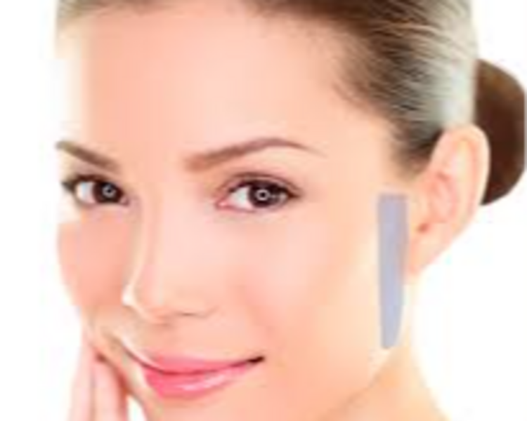 DEPILACIÓN LÁSER XS - MUJER