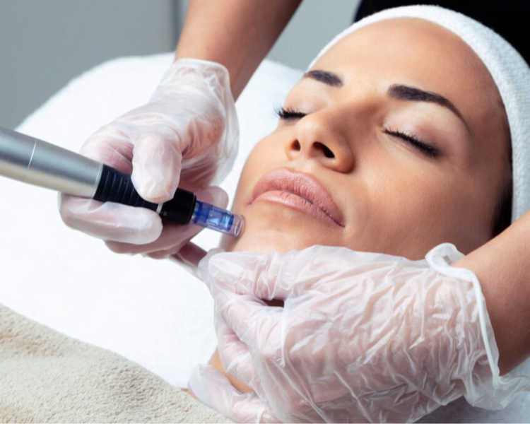 Dermapen - Microneedling Facial PRO EXOSOMAS