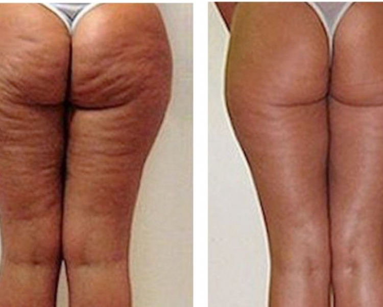 Paquete Pompi Wow 10 sesiones