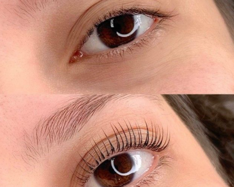 Lifting de Pestañas