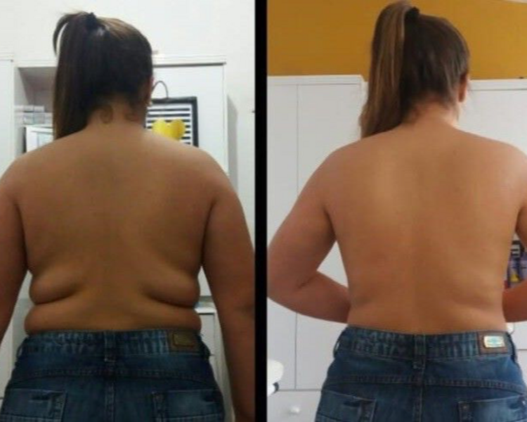 Masaje Reductivo Manual