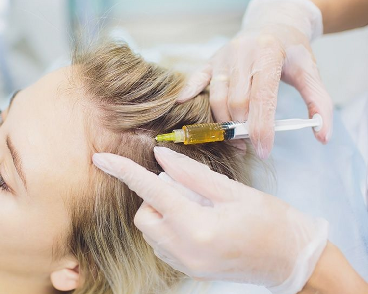 Plasma Rico en Plaquetas Capilar