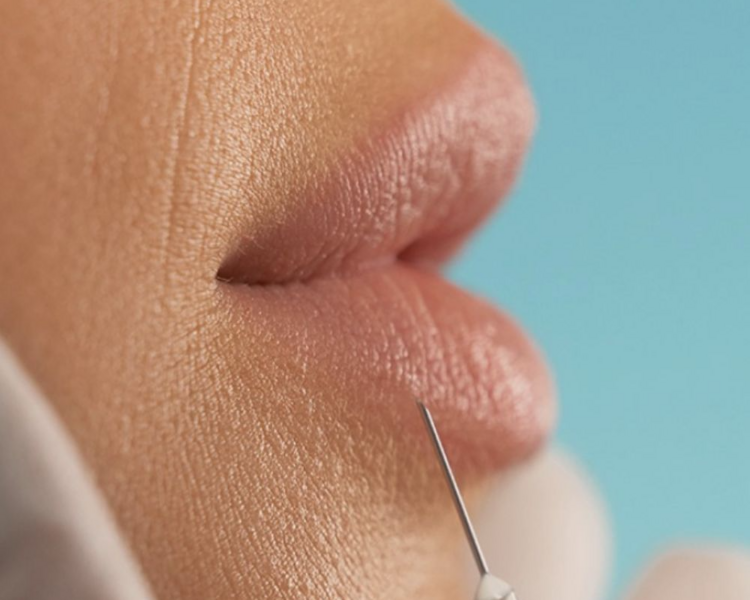 Perfilado/Volumen Labios