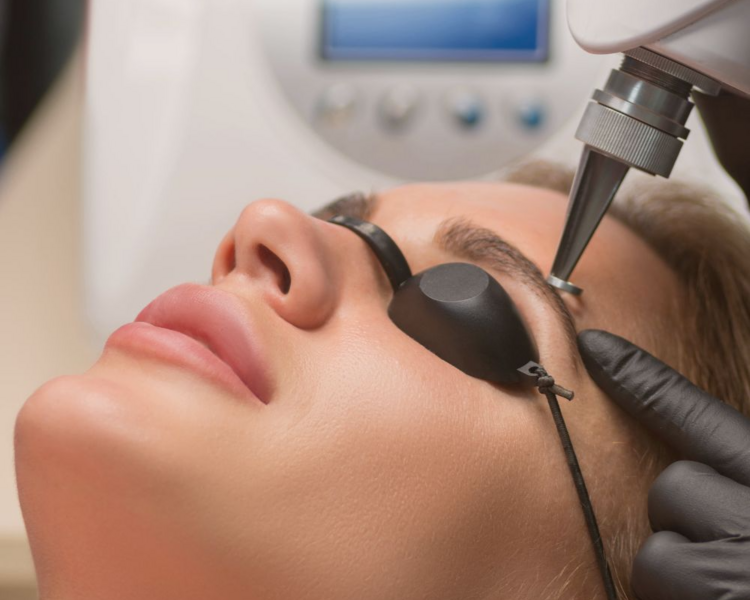 Remocion de microblading