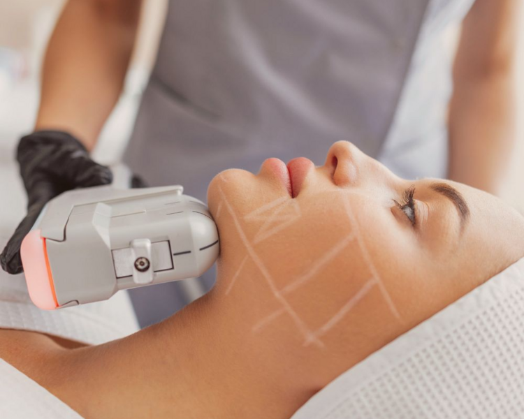 HIFU  (Rostro, Cuello y Escote)