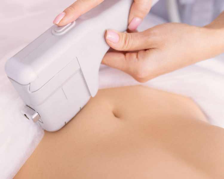 Radiofrecuencia Fraccionada Microagujas Corporal (Morpheus)