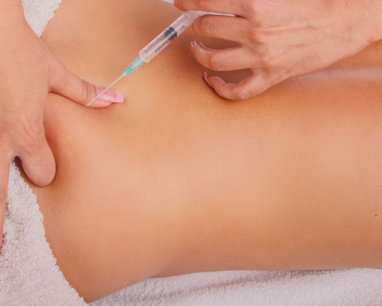 Mesoterapia Corporal (reductora/ anticelulitica/ tensora) ESCENCIAL