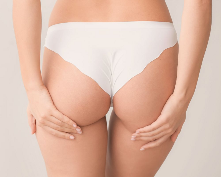 Endopeel (levanta tu gluteos)