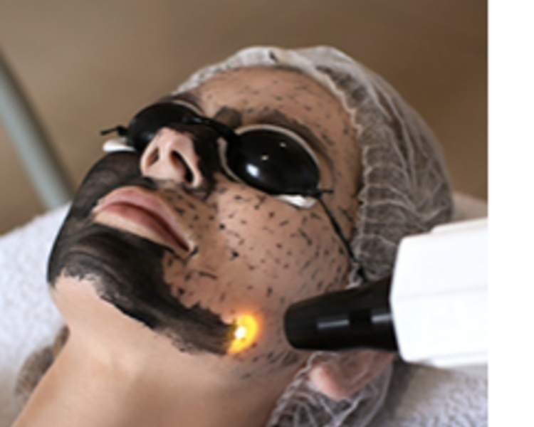 RITUAL HOLLYWOOD PEEL