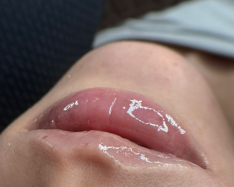 Hidratacion de labios 