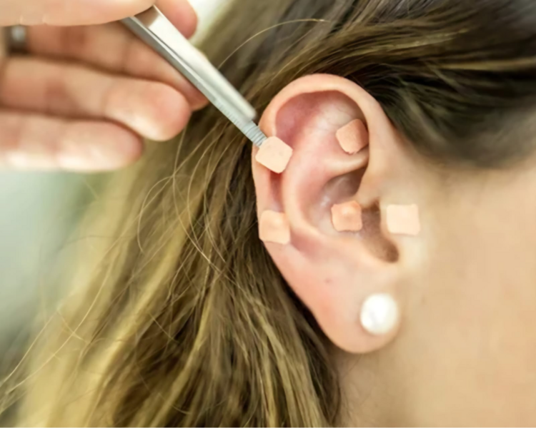 Tecnicas de la medicina  china tradicional