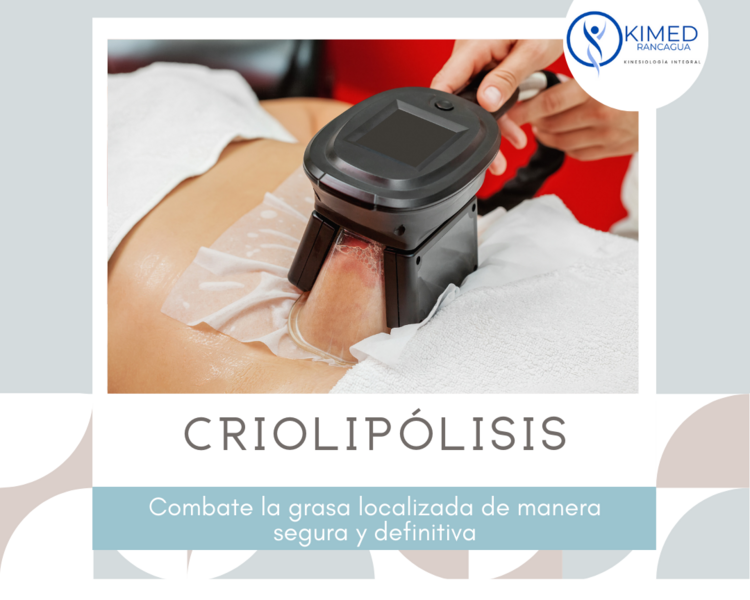 Criolipólisis 360 Abdomen 