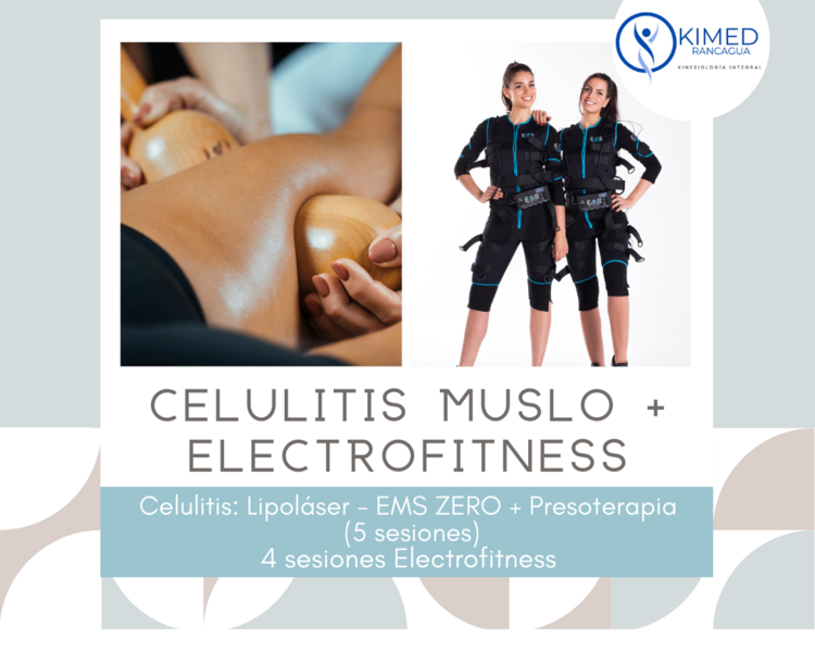 Legs Up – Adiós Celulitis + Electrofitness (Muslos)