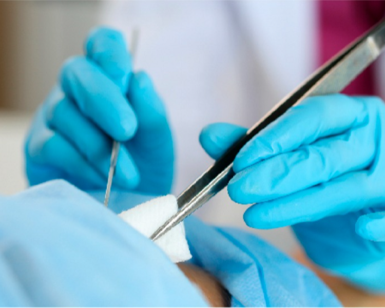 EVALUACIÓN CURACIONES SIMPLES Y AVANZADAS 🩹