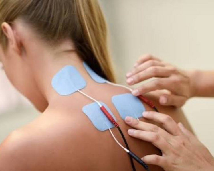 TERAPIA DE ELECTROESTIMULACIÒN