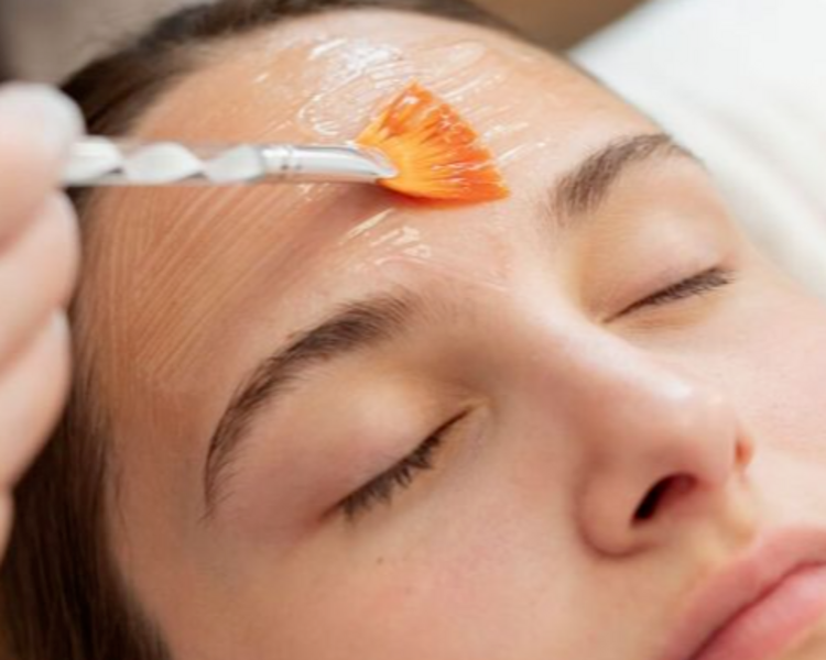 Peeling médico químico