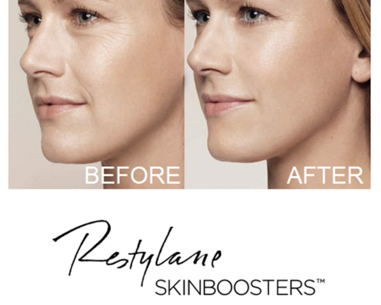 Skinbooster - skin quality