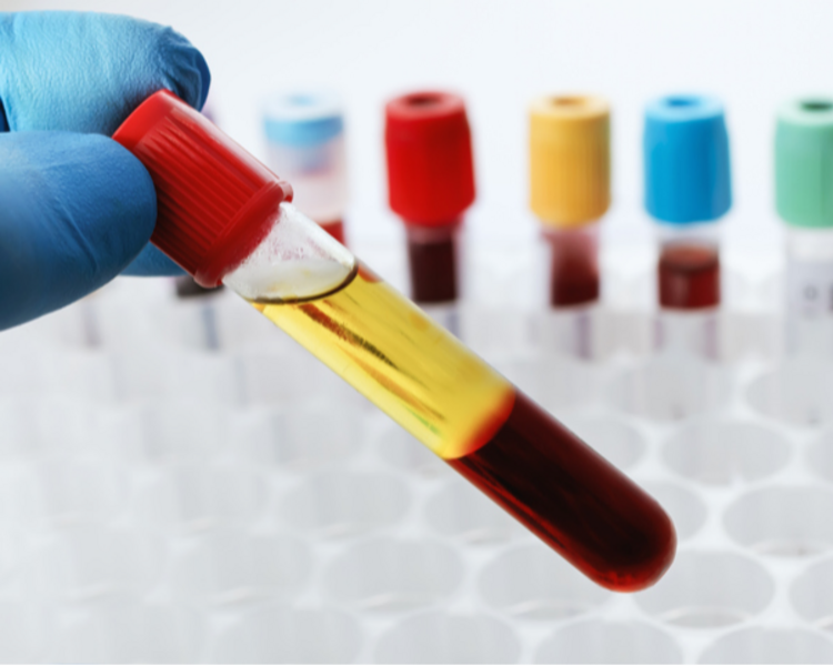  Test Epigenético y ADN 