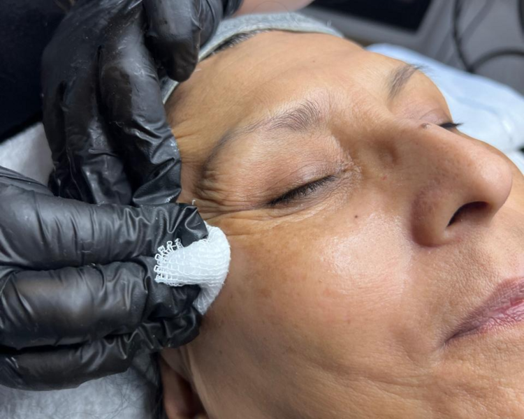 Tratamiento Anti age