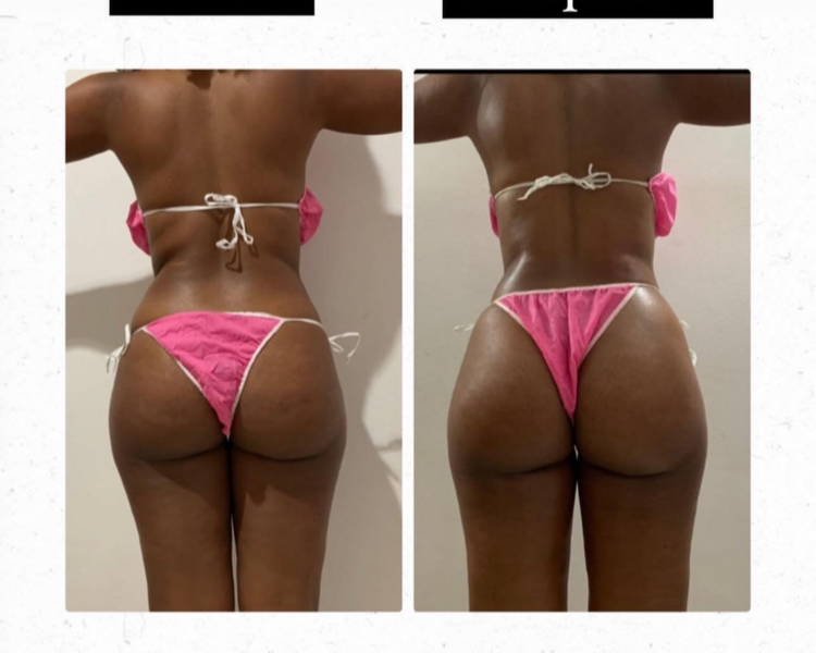 PAQUETE CUERPO COMPLETO 10 SESIONES