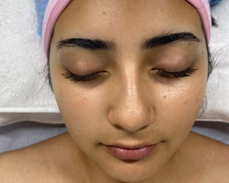 Limpieza facial profunda vip (Hidrafacial) 