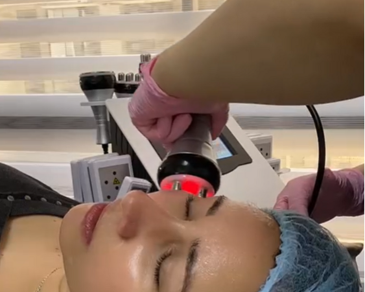 Tratamiento Lifting facial sin cirugía (3 sesiones)