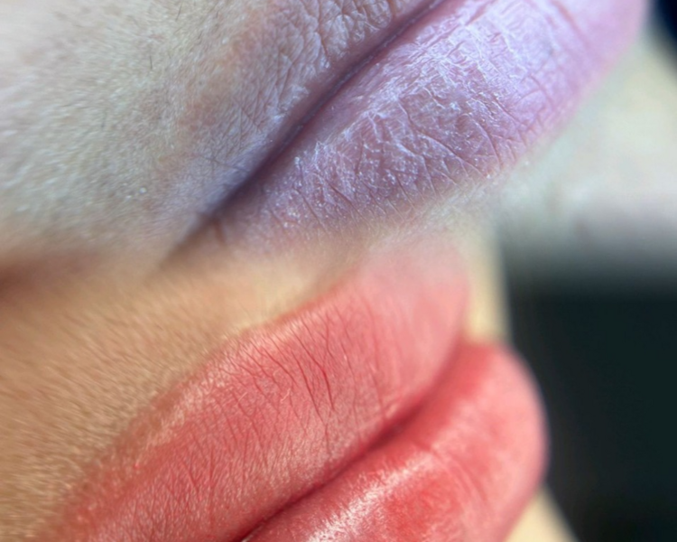 Micropigmentacion de labios Neutralización