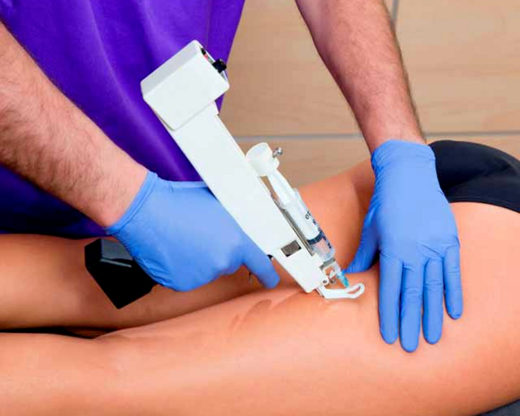 Mesoterapia - Pack de 4 Sesiones