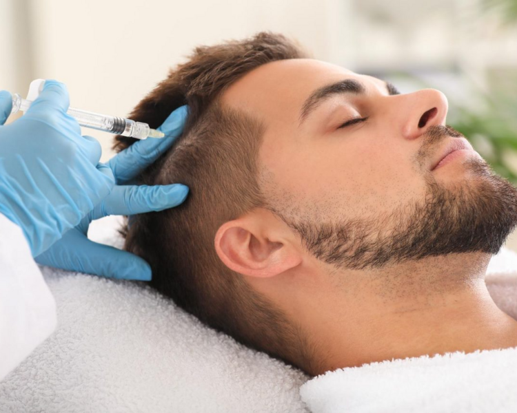 Tratamiento Mesoterapia Capilar