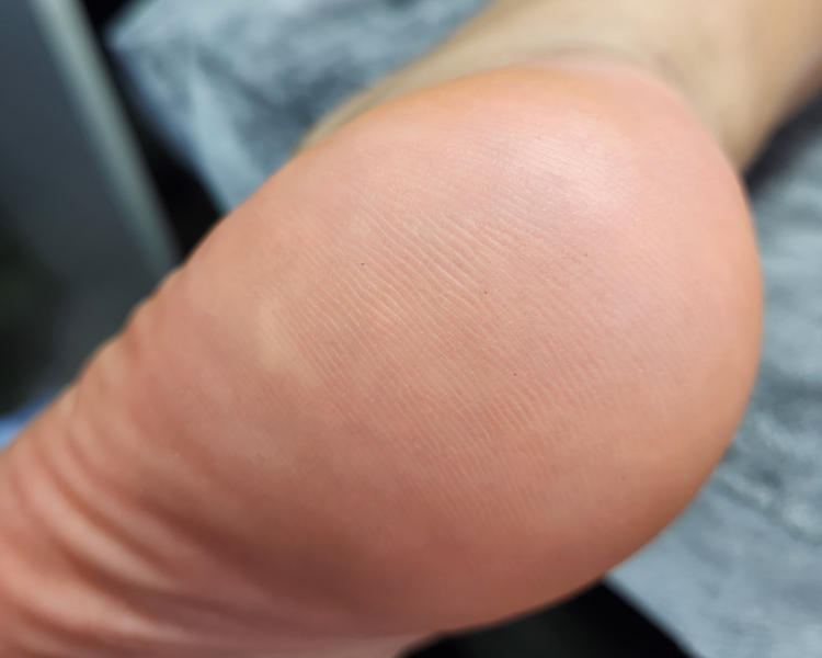 Podoestética premium + esmaltado semipermanente 