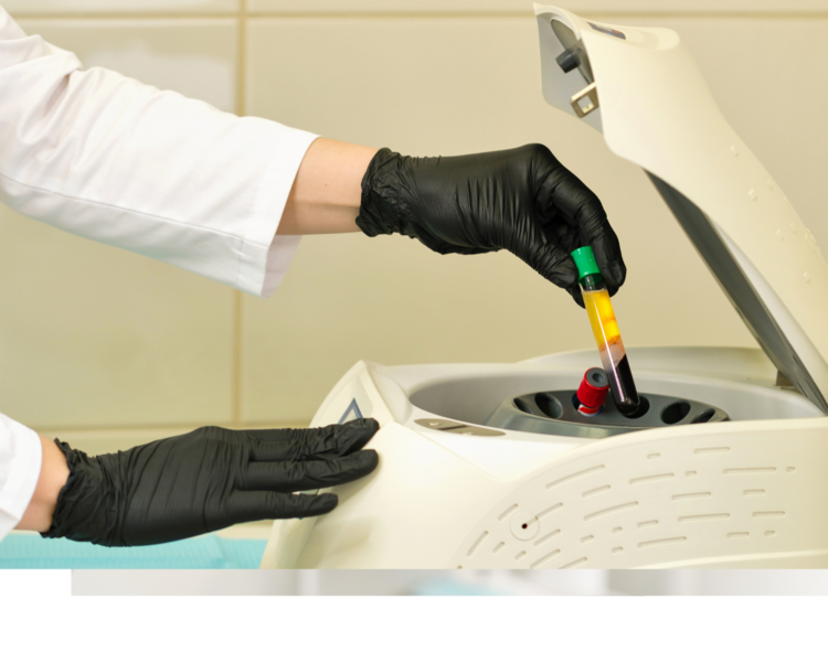 Plasma Rico en Plaquetas