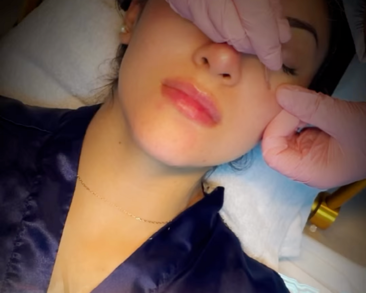 Limpieza facial + limpieza capilar