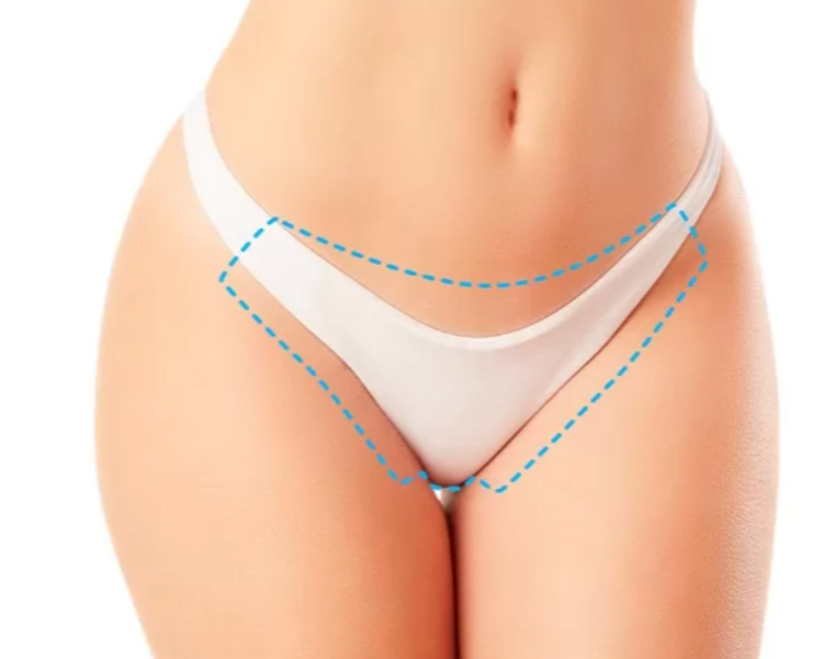 blanqueamiento intimo