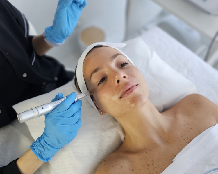 EXO-LIFT X 4 SESIONES (EXOSOMAS EN ROSTRO+PAPADA+CUELLO+ESCOTE)