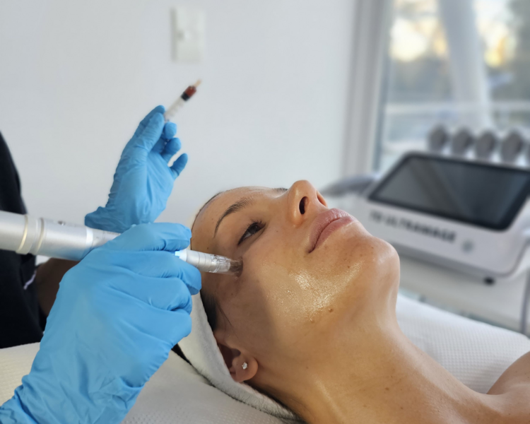 LIMPIEZA+FC-LIFT (FACTORES DE CRECIMIENTO EN ROSTRO+PAPADA+CUELLO)