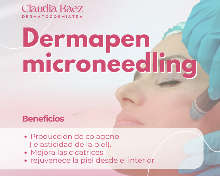 Microneedling(dermapen)