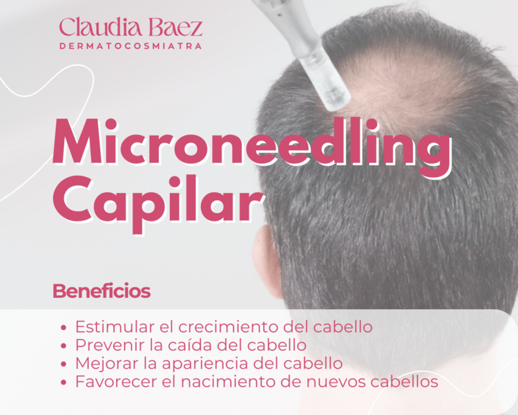 Tratamiento Capilar (con dermapen) 