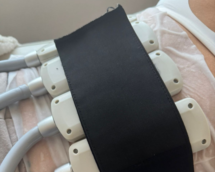 Criolipolisis Plana + IEMS   (  8 placas)