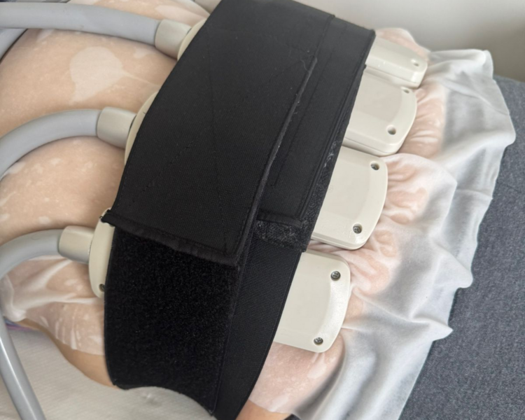 Criolipolisis Plana + IEMS (4 Placas) 