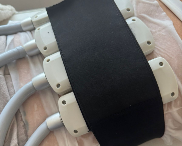 Criolipolisis + IEMS (12 PLACAS)