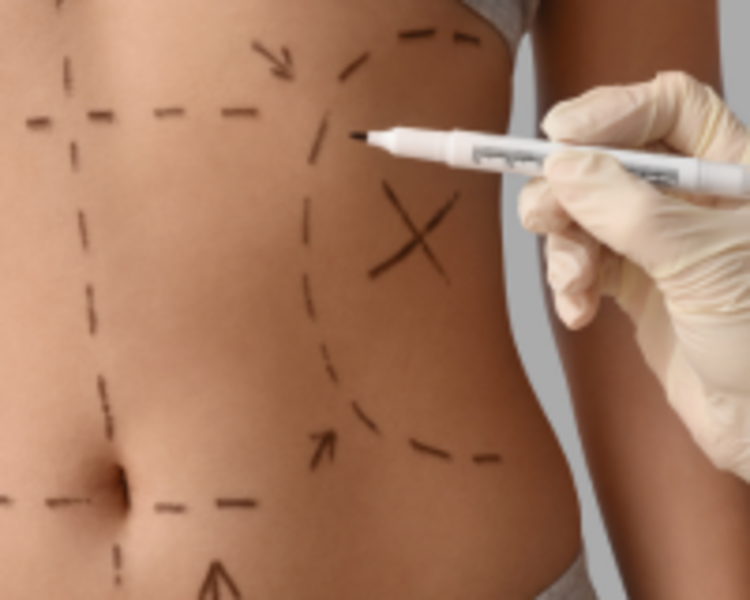 Masaje Post-Lipoescultura