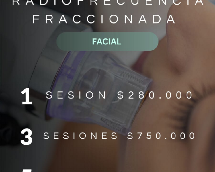 RADIOFRECUENCIA FRACCIONADA FACIAL