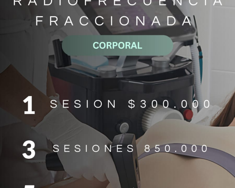 RADIOFRECUENCIA FRACCIONADA CORPORAL