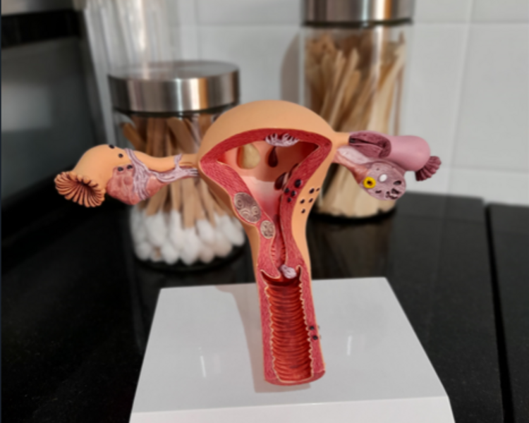 Consulta + Pap + videocolposcopía