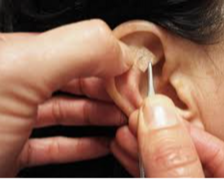 SEGUIMIENTO Acupuntura