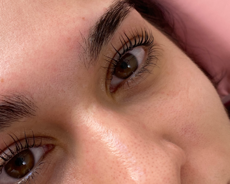 Laminado Completo + Lifting Completo