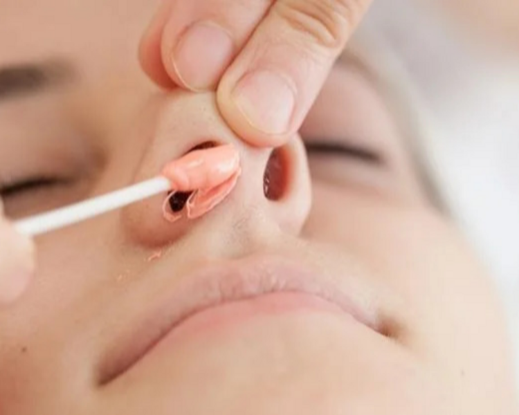 DEPILACIÓN DE NARIZ