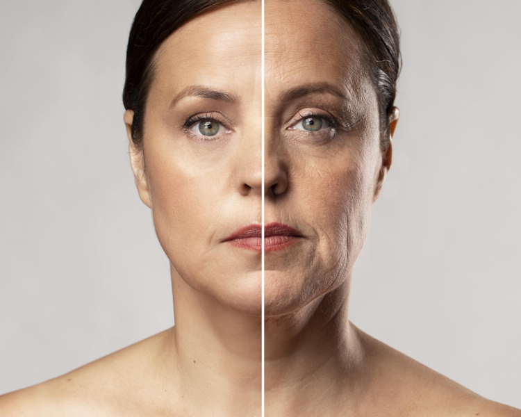 LIMPIEZA FACIAL PROFUNDA + LIFTING FACIAL